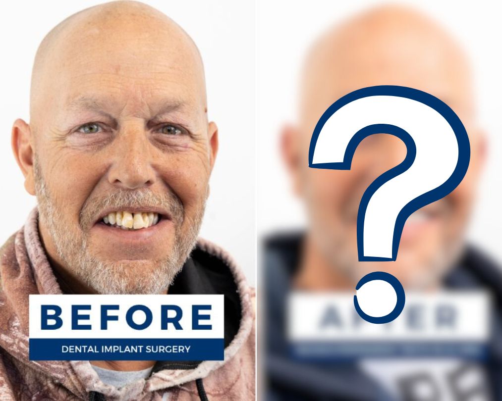 How a New Smile Could Change You(00)